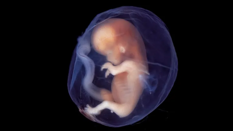 The inspired Word of God shows that our Creator regards the preborn baby, even at the earliest moment of its life and development, as a uniquely new and precious individual. A baby fetus.