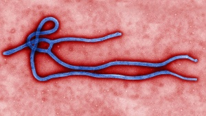 Magnified Ebola virus