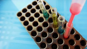 medical test tubes