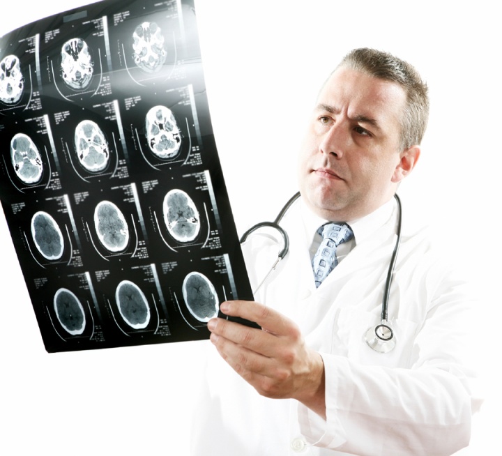 A doctor holding an xray.