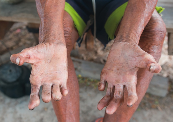 A man's arms and hands.