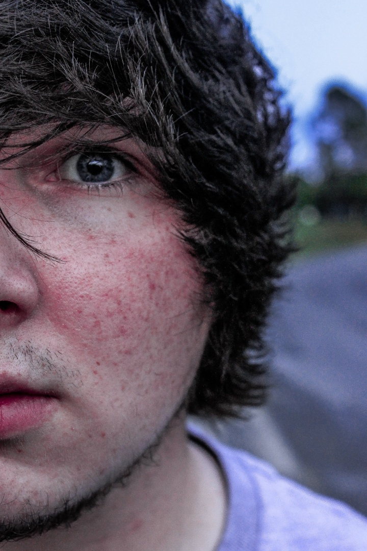 Upclose photo of a young man's face.