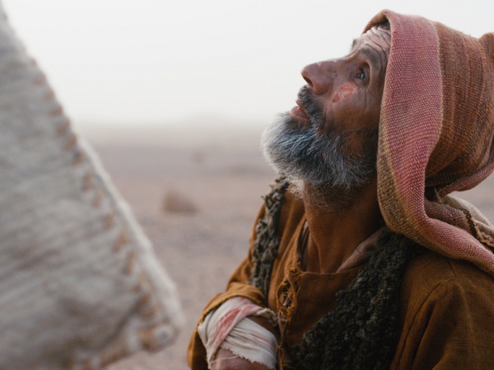 A photo illustration of an old man with leprosy looking up.