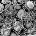 Red blood cells trapped in a fibrin network in a blood clot