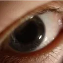 Giving Sight to the Blind