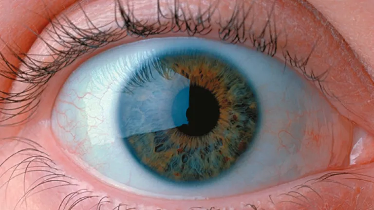 How could the eye, with its many intricate, interacting structures, have evolved through a random process? Close up of a human eye.
