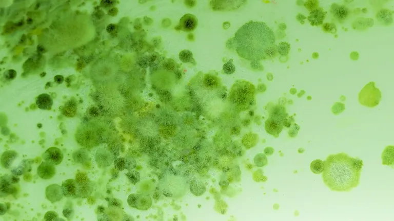 Viruses under a microscope.