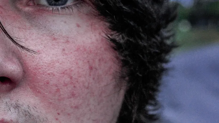 Upclose photo of a young man's face.