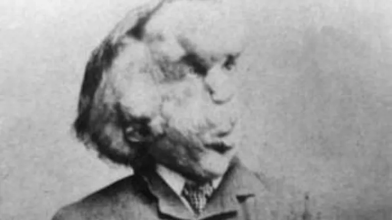 Dr. Treves and the Elephant Man Joseph Merrick - "Elephant Man"