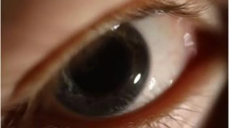 Giving Sight to the Blind Giving Sight to the Blind