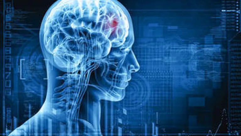 Mapping the Brain: The Missing Dimension Digital images of brain