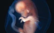 A fetus in the womb.
