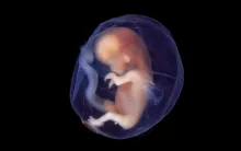 A baby fetus.